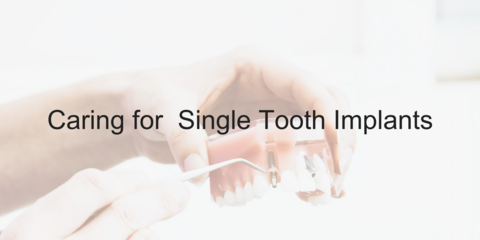 Caring for a Single Tooth Implants - Video