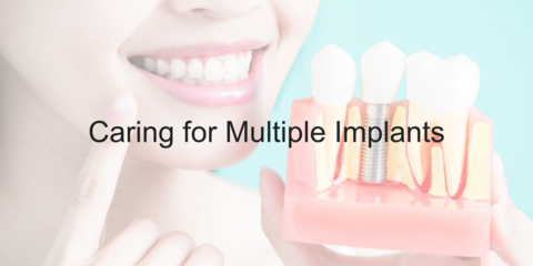 Caring for Multiple Implants - Video